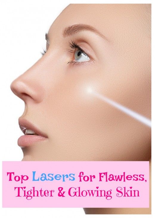 Facial laser tyler tx