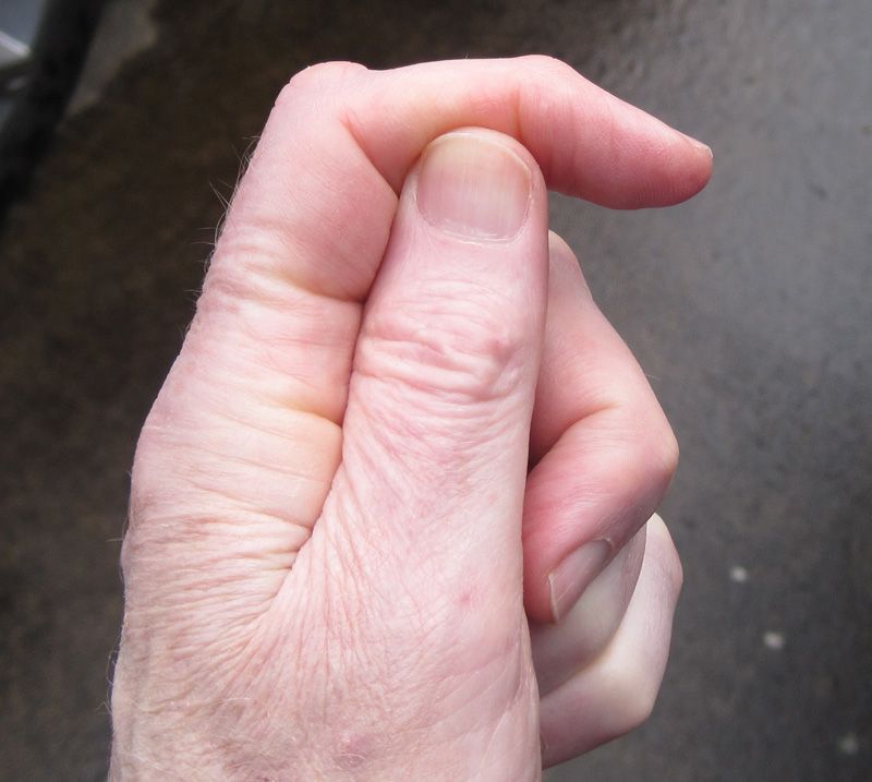 Robber reccomend Thumb and forefinger of non-dominant hand