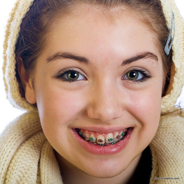 Very young skinny naked girl with braces