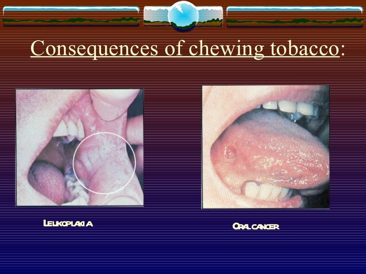 Masturbation with chewing tobacco