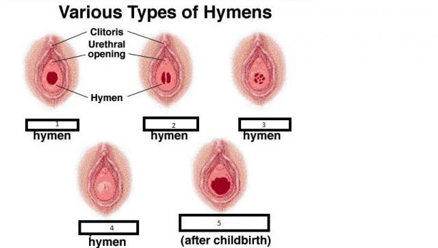 best of No hymen with Vagina