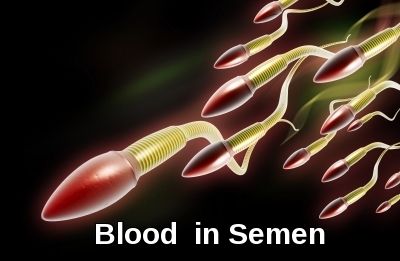 Blood in sperm but clear pee
