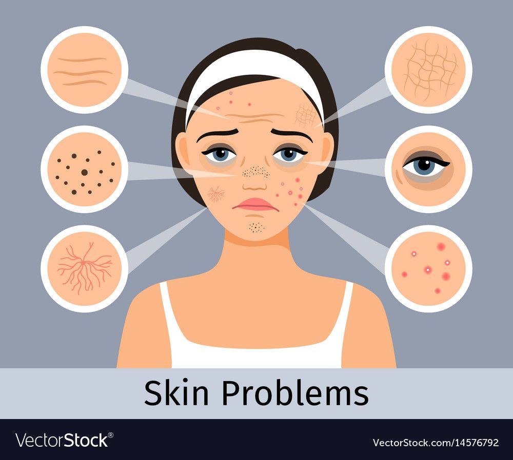 best of Skin problmes Facial