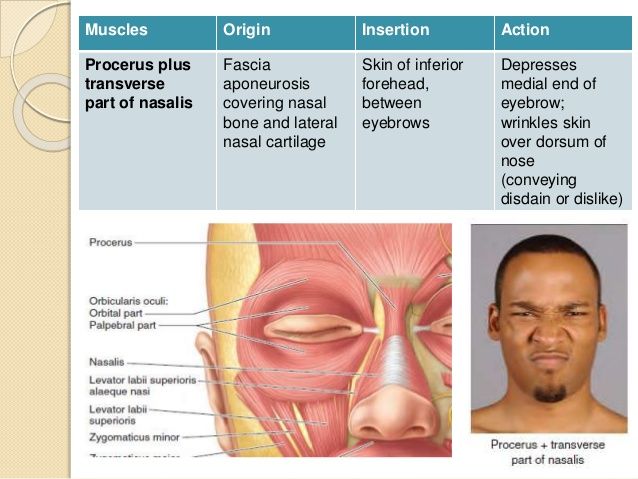 Facial expression caused by corrugator supercilii