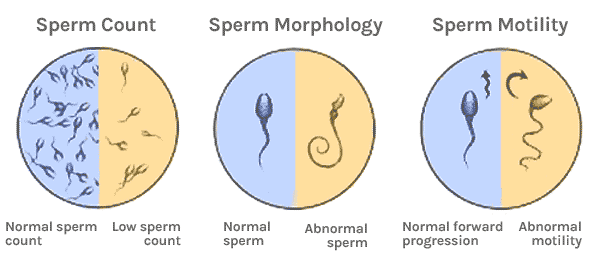 Abnormalities in sperm