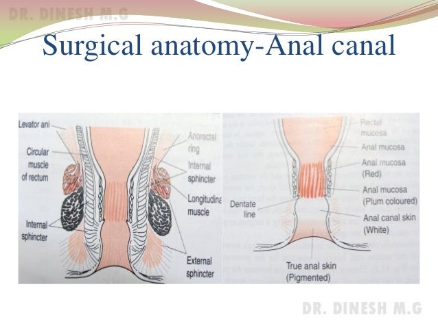 Ectopic anal canal