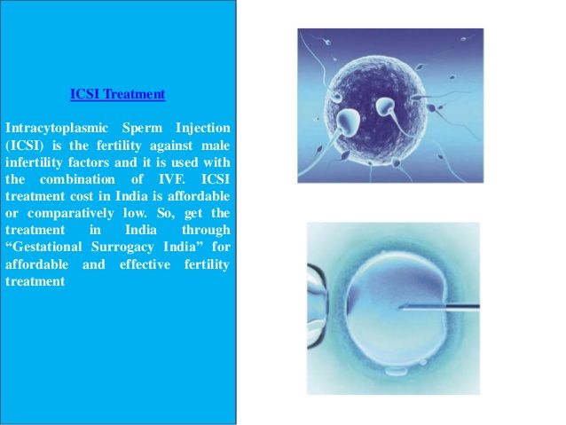 best of Costs Intracytoplasmic icsi sperm injection